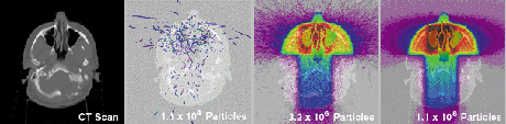 Figure 1: A scan followed by simulations involving 10,000 to 10 million particles (courtesy Lawrence Livermore Labs).