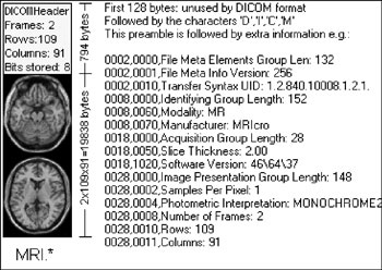 Figure 1: A DICOM file, composed of the data header 
and the image.