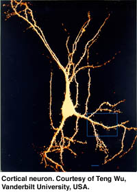 Cortical neuron. Courtesy of Teng Wu, Vanderbilt University, USA.