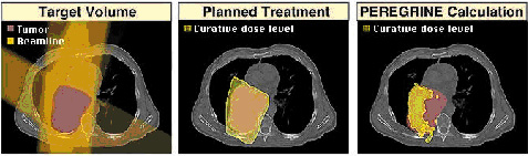 Figure 2: The tumour is shown in the first figure, the planned treatment in the second (analytical approach). In the third a Monte Carlo simulation shows that not all the tumour has been irradiated.