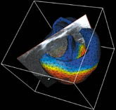Biomechanical Model of the Heart (© INRIA Epidaure Research Project).