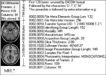 Figure 1: A DICOM file, composed of the data header
and the image.