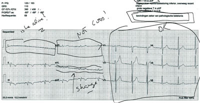 Ambulant Annotator allows physicians to annotate electro cardiograms in an electronic medical file.