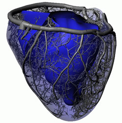 Figure 1: Whole heart model.